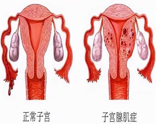 不育不孕治疗