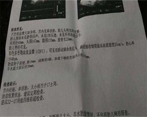 不孕不育免费咨询